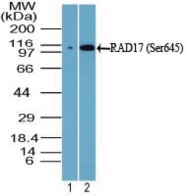 Western Blot: Rad17 [p Ser645] Antibody [NBP2-24457]